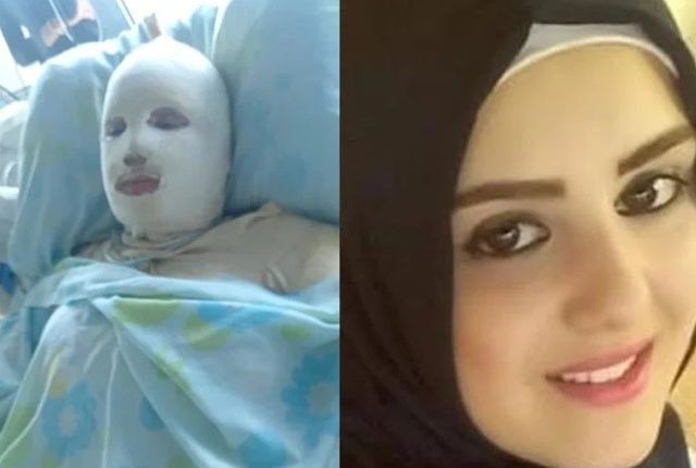 اسقاط حمل سے انکار پر شوہر نے بیوی کو آگ لگا دی