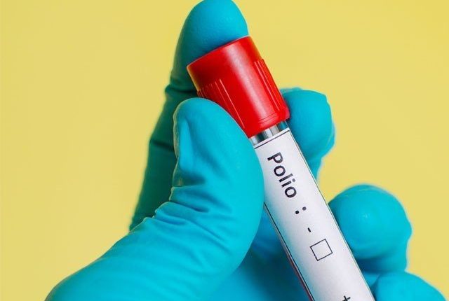 نیویارک میں پولیو وائرس کی موجودگی، ڈیزاسٹر ایمرجنسی نافذ کردی گئی