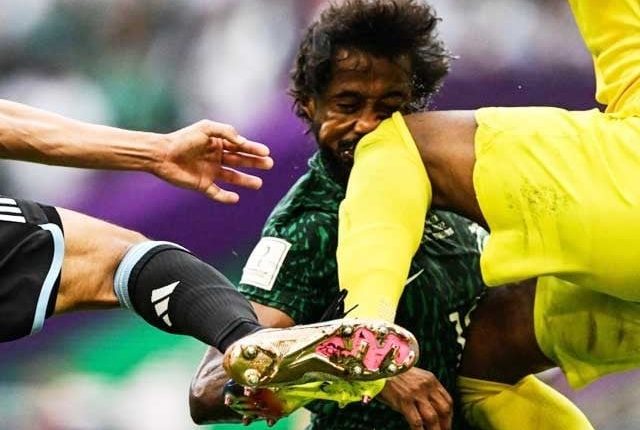 ارجنٹائن کیخلاف زخمی ہونیوالے سعودی فٹبالر کا جبڑا، چہرے کی ہڈیاں ٹوٹ گئیں